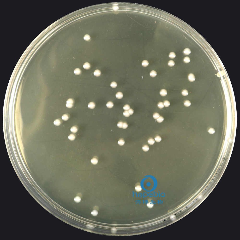 大肠埃希氏菌  无色透明大菌落