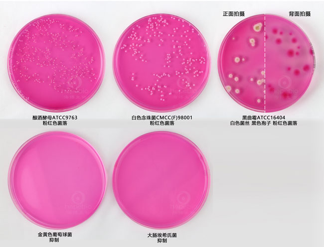 虎红（孟加拉红）培养基上细菌的生长特征