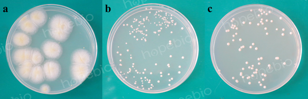 酵母蛋白胨培养基微生物质控结果