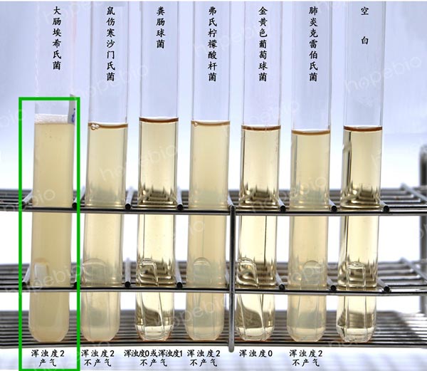 EC肉汤培养不同菌株的结果（浑浊产气的为大肠埃希氏菌）