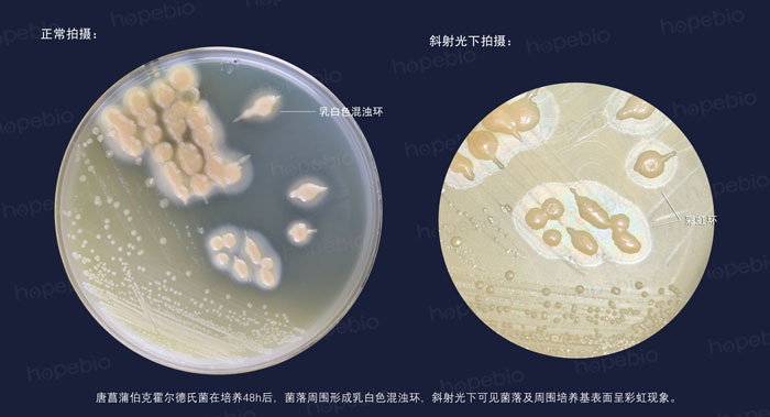 卵黄琼脂——唐菖蒲伯克霍尔德氏菌