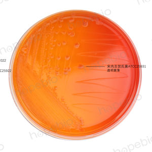 MAC-福氏志贺氏菌、大肠埃希氏菌、宋内志贺氏菌、痢疾志贺氏菌/
